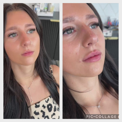 Lip Rehab Bundle